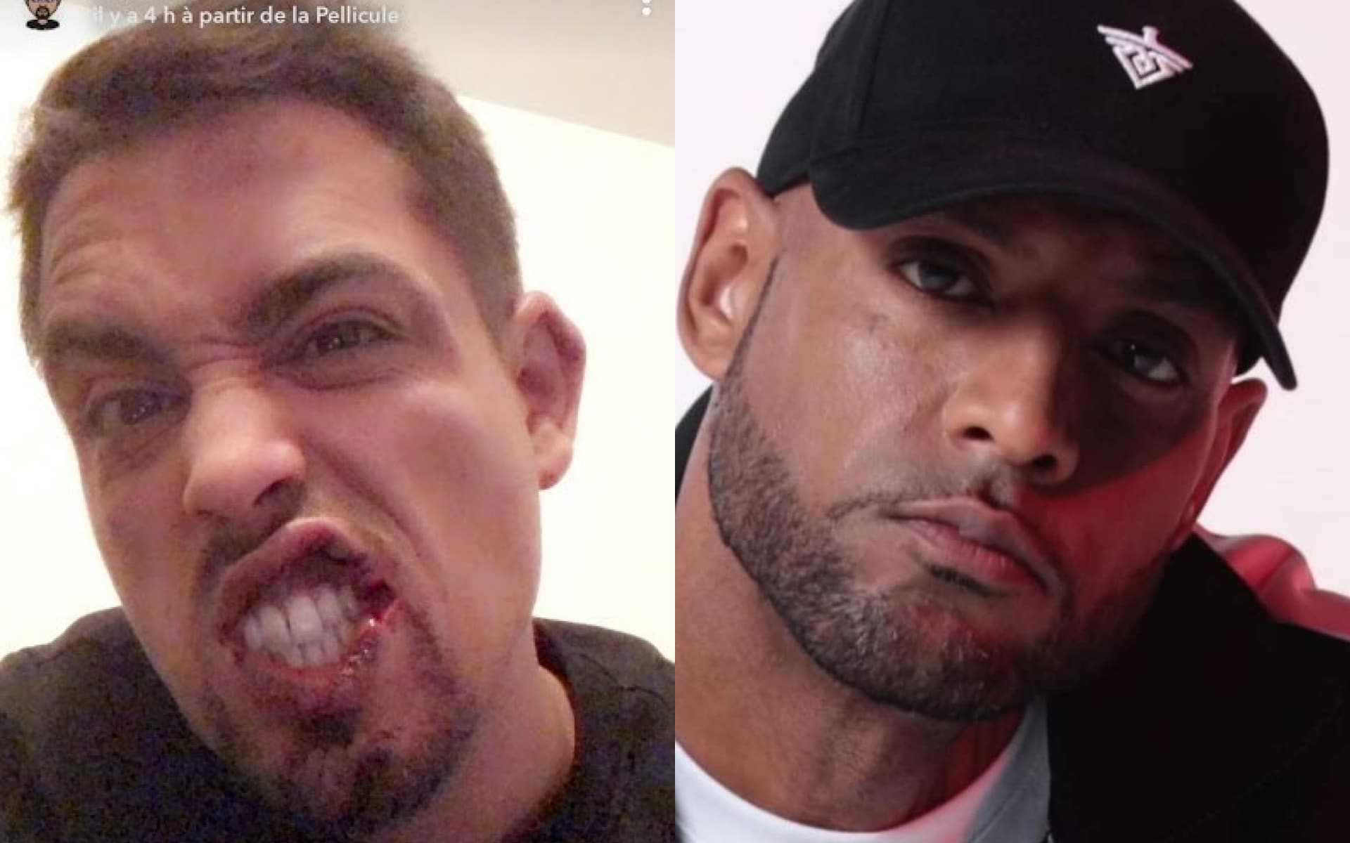 Lartiste cause de son agression sur Twitter, Booba se moque de lui sur Instagram