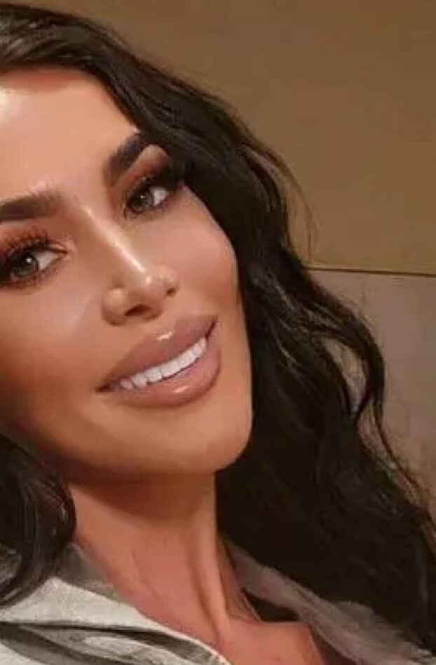 Une sosie de Kim Kardashian s'est éteinte après une opération chirurgicale