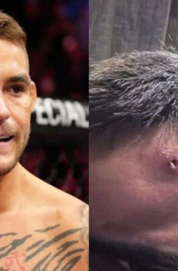 « Que des belles paroles » : Dustin Poirier doute des justifications de Benoit Saint-Denis