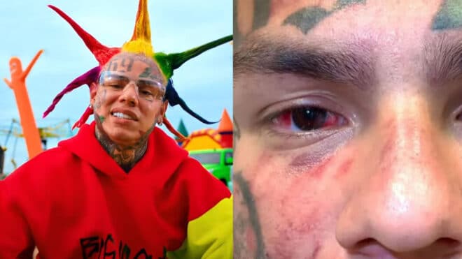 6ix9ine réclame un million de dollars en dommages et intérêts après son agression à la salle de sport